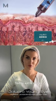 Jalupro® Young Eye
